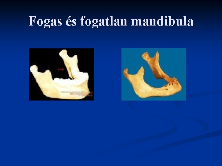 Fogas és fogatlan mandibula 