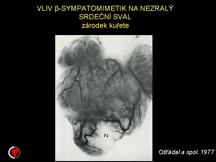 VLIV β-SYMPATOMIMETIK NA NEZRALÝ SRDEČNÍ SVAL zárodek kuřete Ošťádal a spol. 1977 