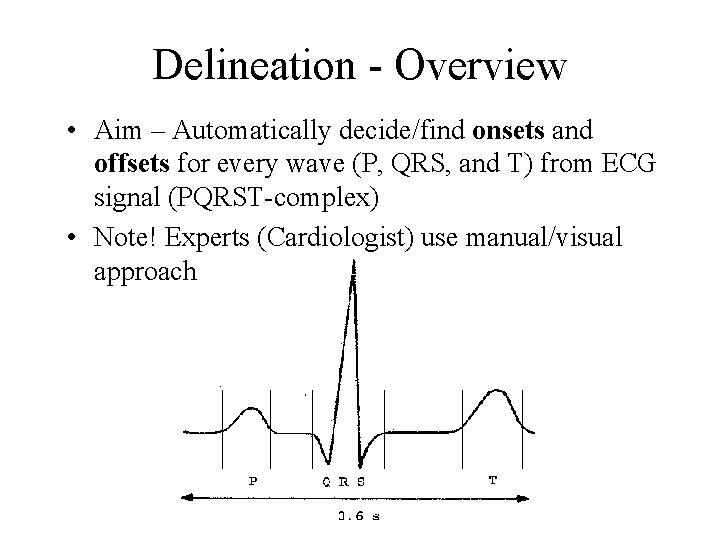 Delineation - Overview • Aim – Automatically decide/find onsets and offsets for every wave