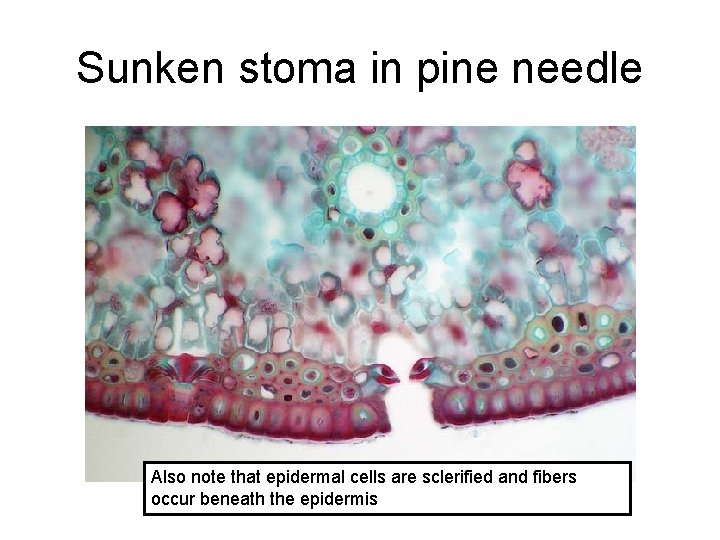 Sunken stoma in pine needle Also note that epidermal cells are sclerified and fibers