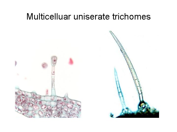 Multicelluar uniserate trichomes 