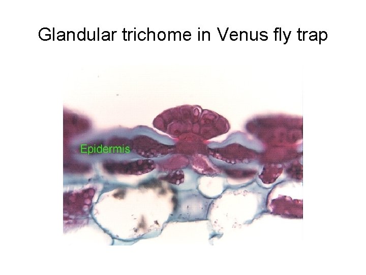 Glandular trichome in Venus fly trap 