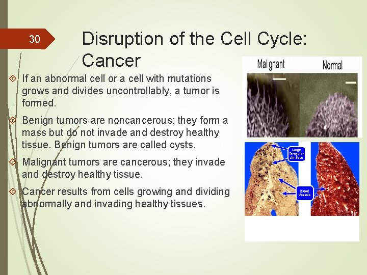 30 Disruption of the Cell Cycle: Cancer If an abnormal cell or a cell