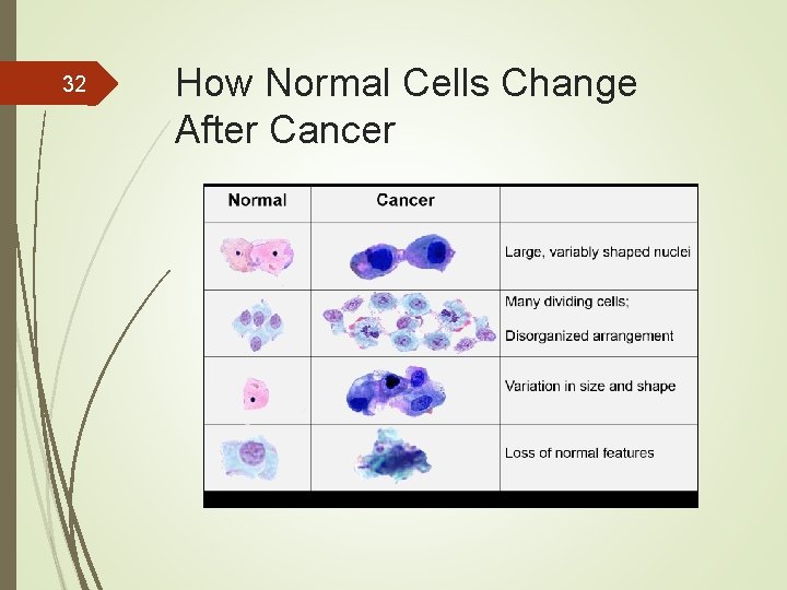 32 How Normal Cells Change After Cancer 