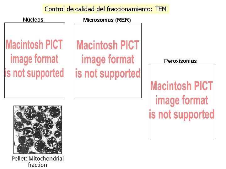 Control de calidad del fraccionamiento: TEM Núcleos Microsomas (RER) Peroxisomas 