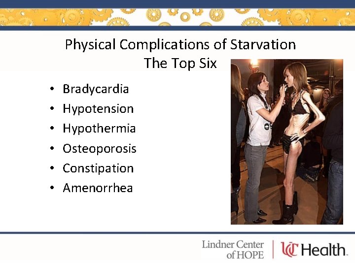 Physical Complications of Starvation The Top Six • • • Bradycardia Hypotension Hypothermia Osteoporosis