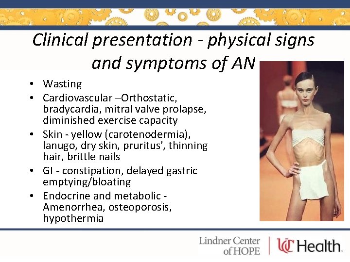 Clinical presentation - physical signs and symptoms of AN • Wasting • Cardiovascular –Orthostatic,