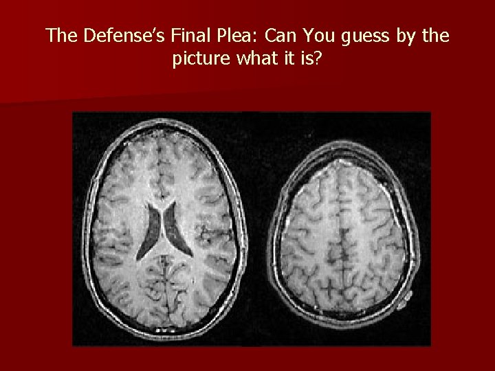 The Defense’s Final Plea: Can You guess by the picture what it is? 