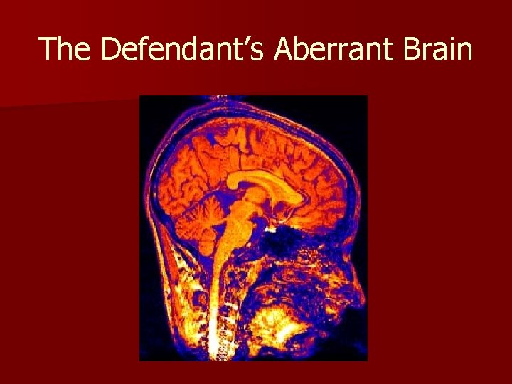 The Defendant’s Aberrant Brain 