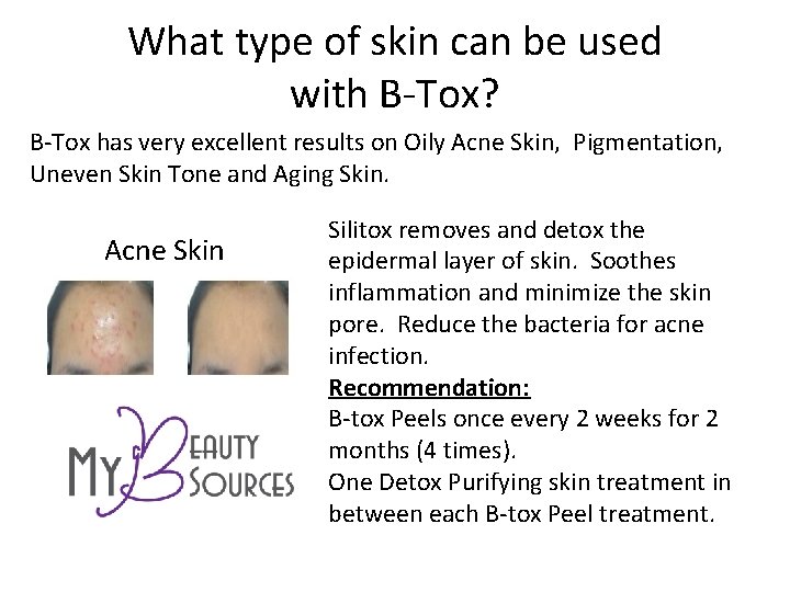 What type of skin can be used with B-Tox? B-Tox has very excellent results