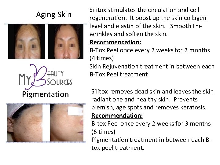 Aging Skin Pigmentation Silitox stimulates the circulation and cell regeneration. It boost up the