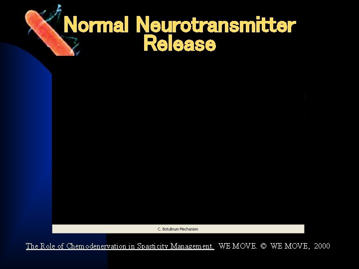 Normal Neurotransmitter Release The Role of Chemodenervation in Spasticity Management. WE MOVE. © WE