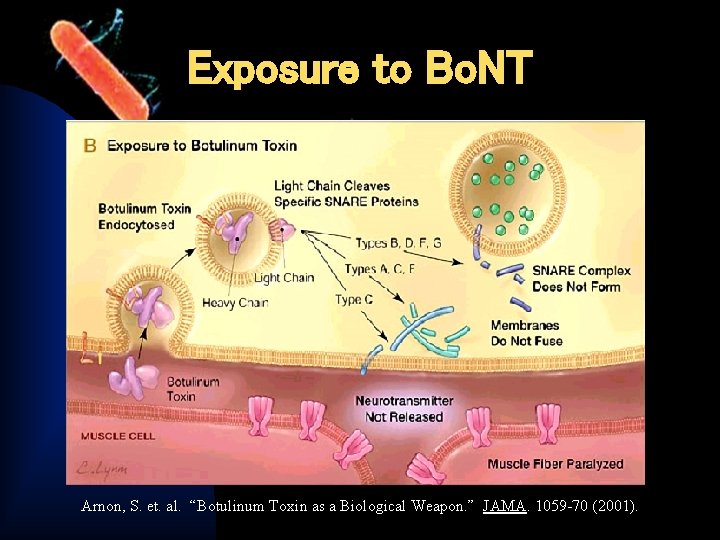 Exposure to Bo. NT Arnon, S. et. al. “Botulinum Toxin as a Biological Weapon.