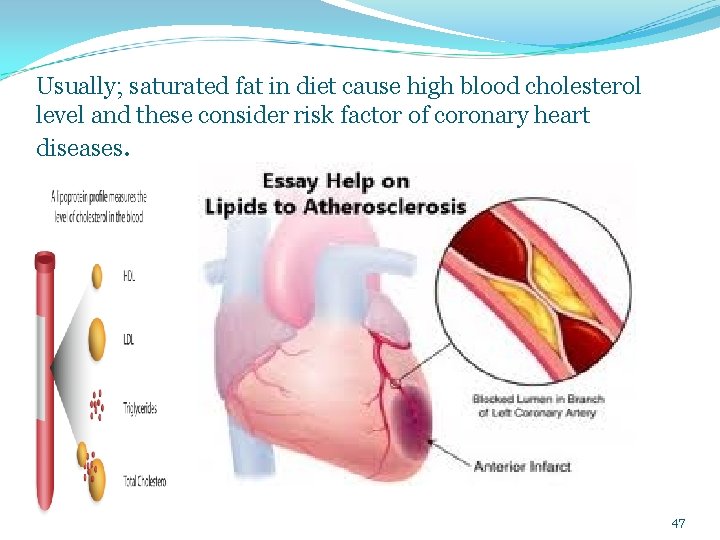 Usually; saturated fat in diet cause high blood cholesterol level and these consider risk