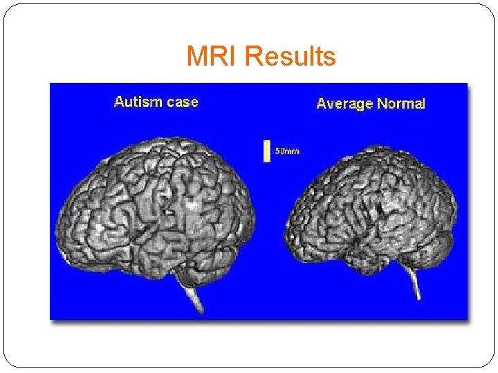 MRI Results 