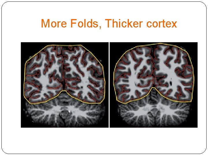 More Folds, Thicker cortex 