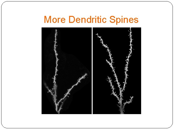 More Dendritic Spines 