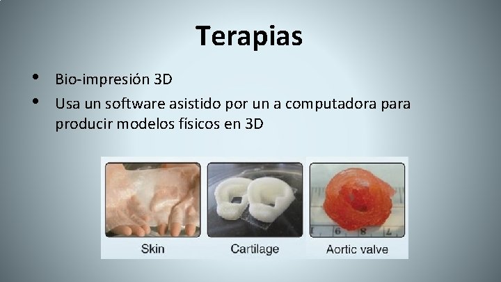 Terapias • • Bio-impresión 3 D Usa un software asistido por un a computadora