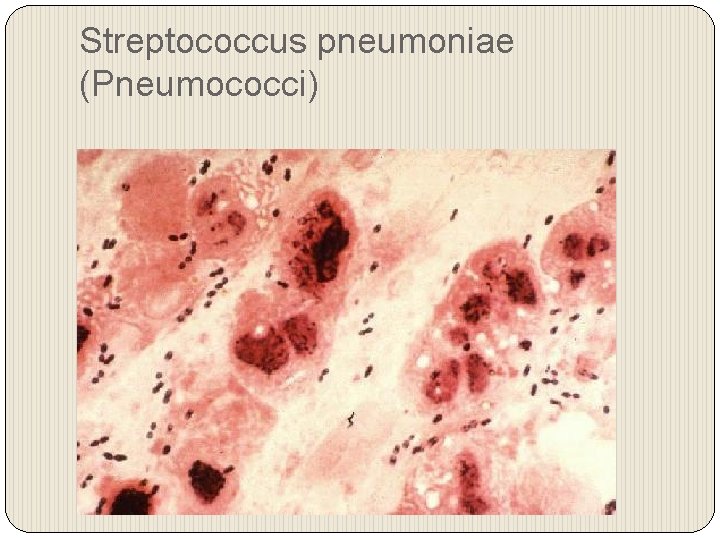Streptococcus pneumoniae (Pneumococci) 