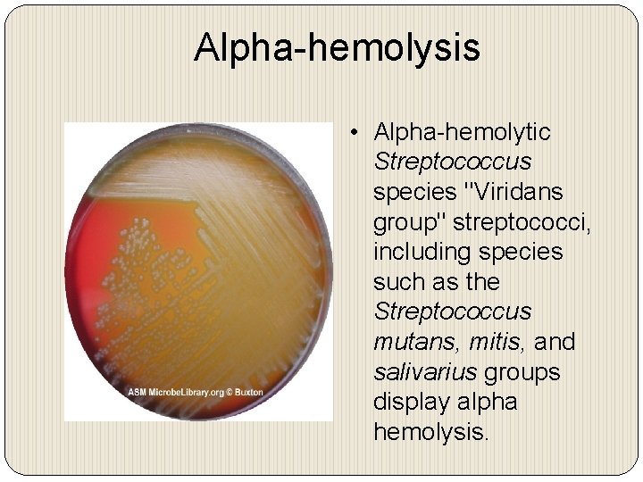 Alpha-hemolysis • Alpha-hemolytic Streptococcus species "Viridans group" streptococci, including species such as the Streptococcus