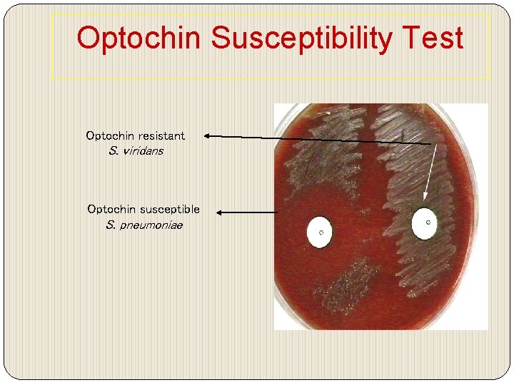 Optochin Susceptibility Test Optochin resistant S. viridans Optochin susceptible S. pneumoniae 