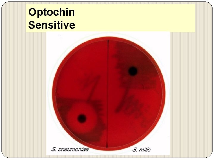 Optochin Sensitive 