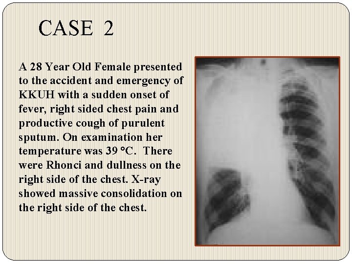 CASE 2 A 28 Year Old Female presented to the accident and emergency of