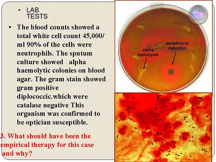  • LAB TESTS • The blood counts showed a total white cell count