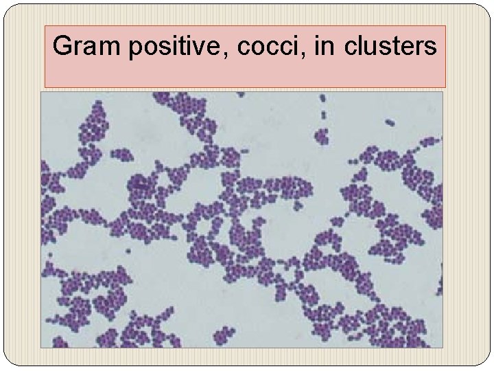 Gram positive, cocci, in clusters 