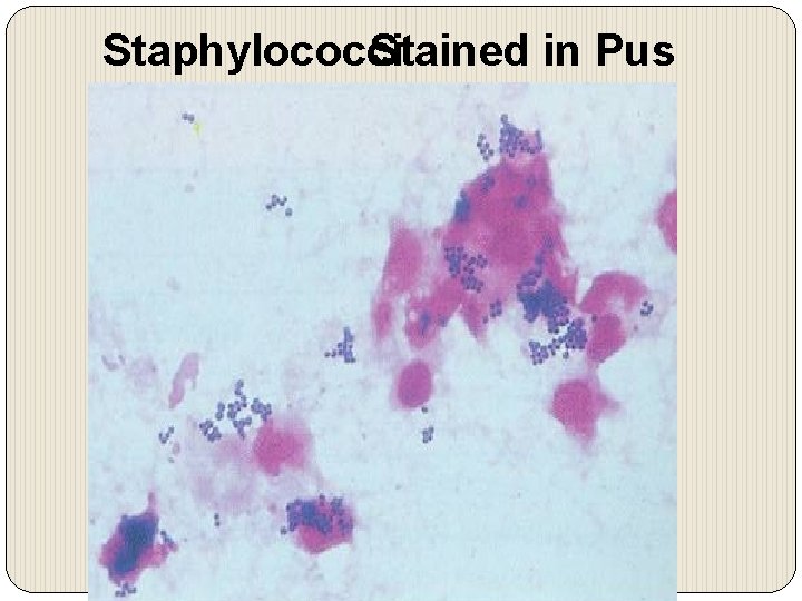 Staphylococci Stained in Pus 