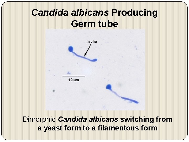 Candida albicans Producing Germ tube Dimorphic Candida albicans switching from a yeast form to