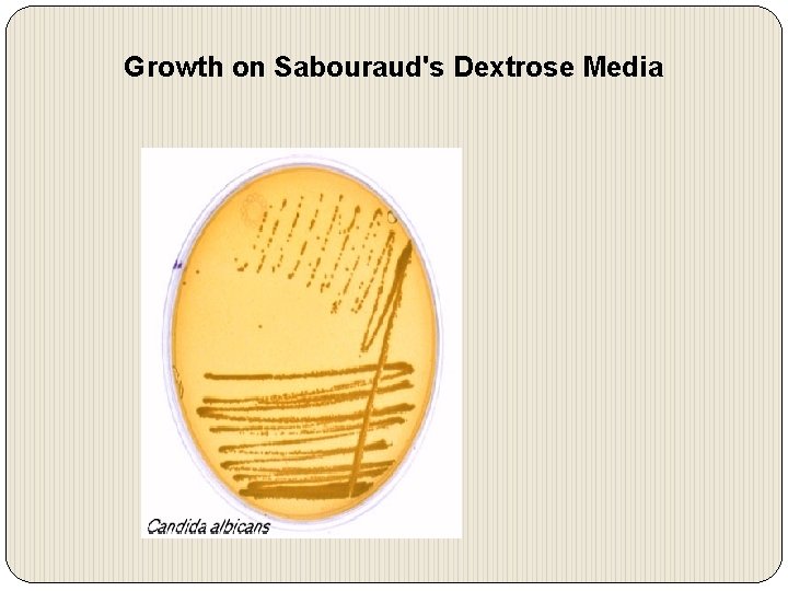 Growth on Sabouraud's Dextrose Media 