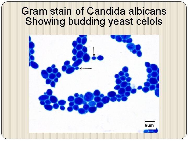 Gram stain of Candida albicans Showing budding yeast celols 