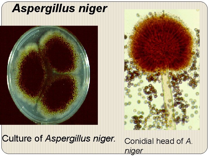 Aspergillus niger Culture of Aspergillus niger. Conidial head of A. niger 