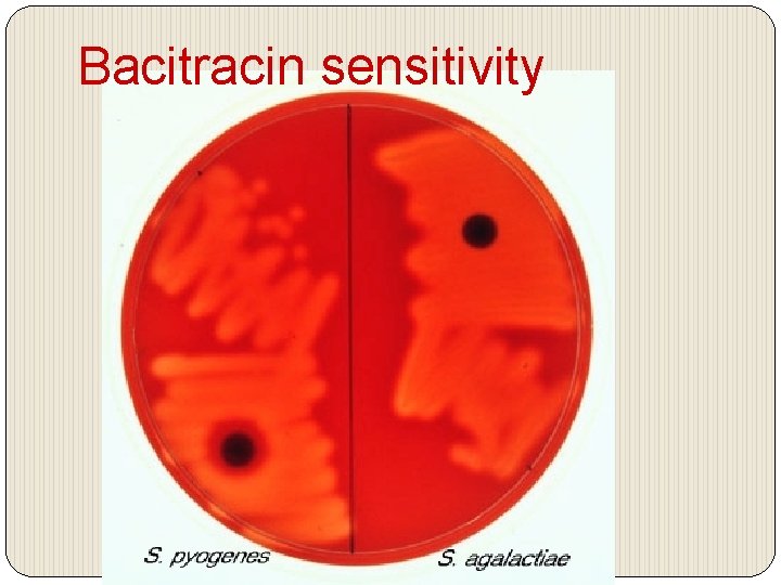 Bacitracin sensitivity 