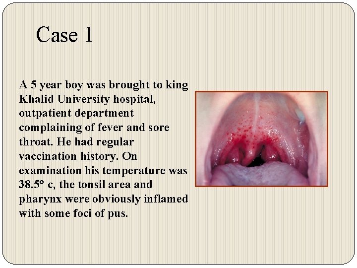 Case 1 A 5 year boy was brought to king Khalid University hospital, outpatient