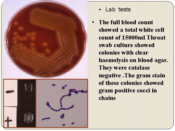  • Lab tests • The full blood count showed a total white cell