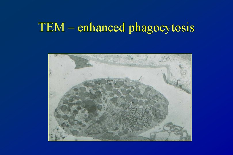 TEM – enhanced phagocytosis 