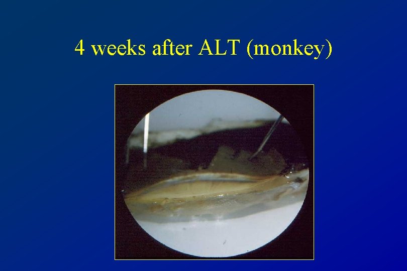 4 weeks after ALT (monkey) 