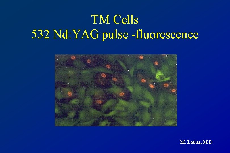 TM Cells 532 Nd: YAG pulse -fluorescence M. Latina, M. D 