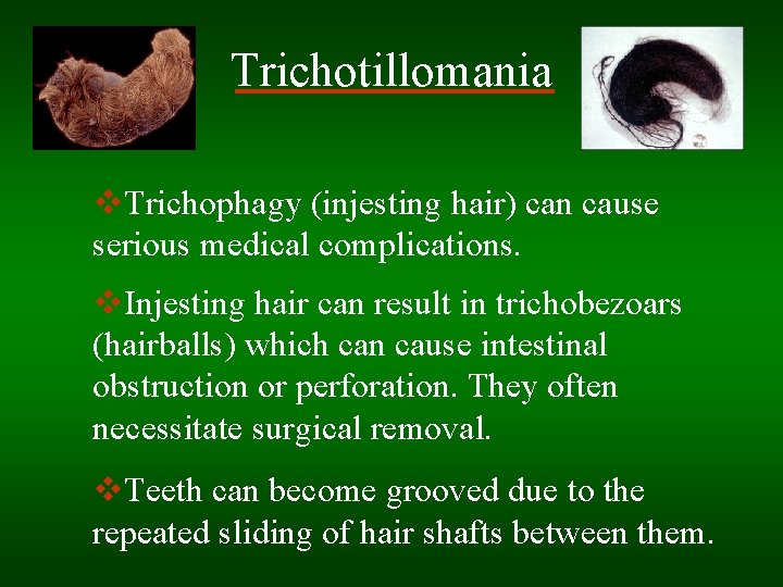 Trichotillomania v. Trichophagy (injesting hair) can cause serious medical complications. v. Injesting hair can