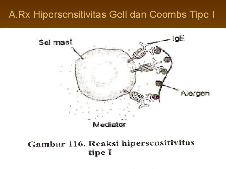 A. Rx Hipersensitivitas Gell dan Coombs Tipe I 