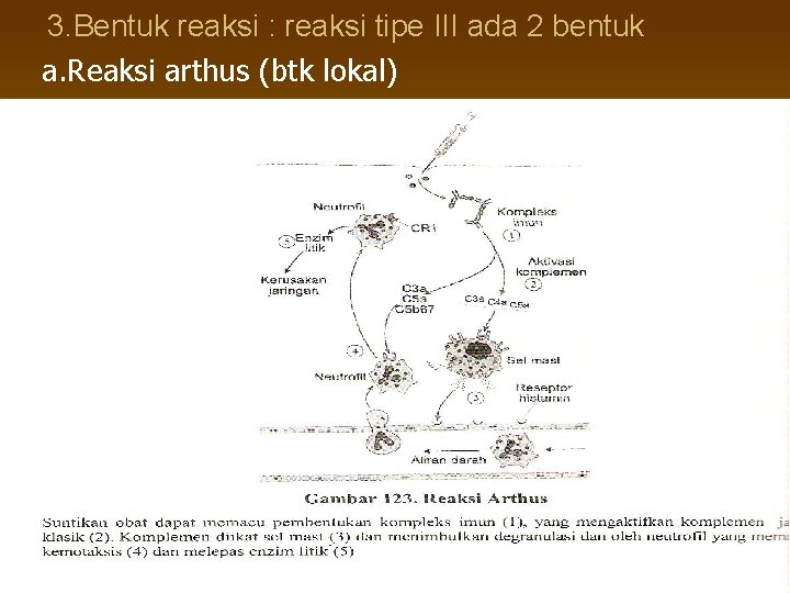 3. Bentuk reaksi : reaksi tipe III ada 2 bentuk a. Reaksi arthus (btk