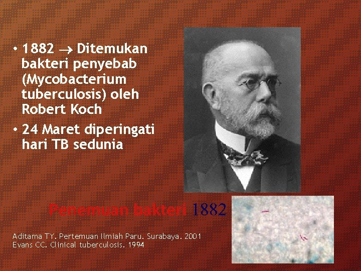  • 1882 Ditemukan bakteri penyebab (Mycobacterium tuberculosis) oleh Robert Koch • 24 Maret