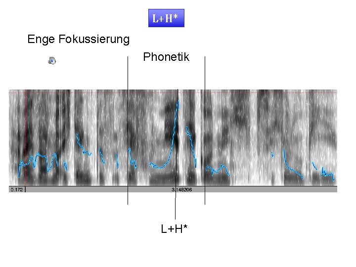 L+H* Enge Fokussierung Phonetik L+H* 