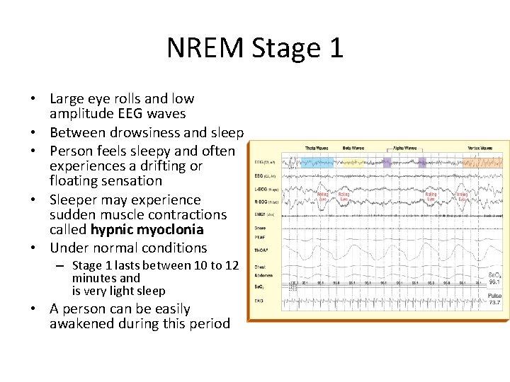 NREM Stage 1 • Large eye rolls and low amplitude EEG waves • Between