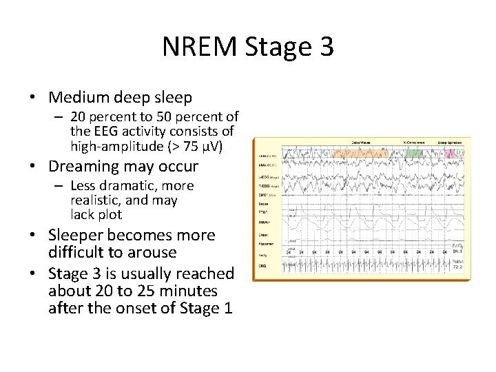 NREM Stage 3 • Medium deep sleep – 20 percent to 50 percent of