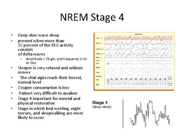 NREM Stage 4 • • Deep slow wave sleep present when more than 50