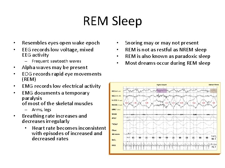 REM Sleep • • Resembles eyes open wake epoch EEG records low voltage, mixed