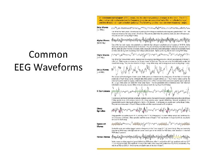 Common EEG Waveforms 